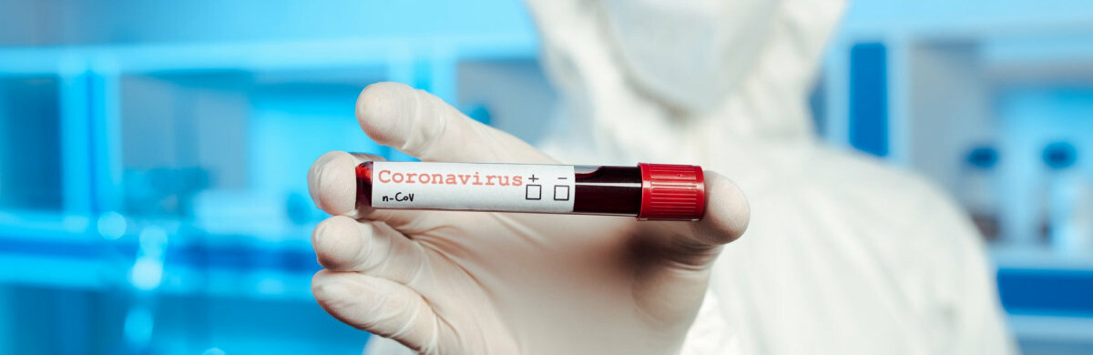  ���� ���������� ����� ���������� ������������� covid-19 