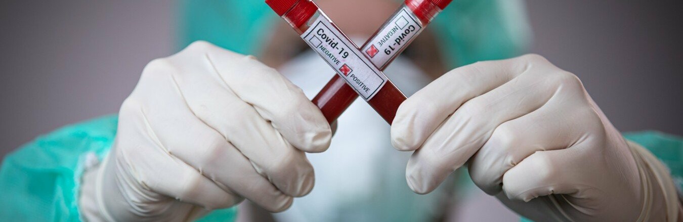  �������� ������� covid-19 ���������� ���� ������ 