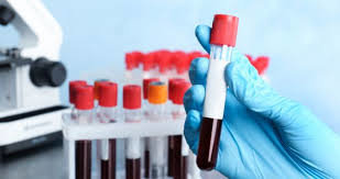  �������������� ����������� ����������� covid-19 ����������� ���������� �������� 