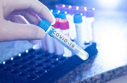  covid-19 ���� ���� �������� ����� 2400 ������ 