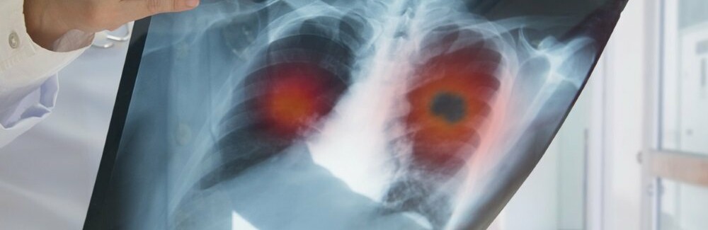  ������������� ����� ������� ���������� ���� ����������� covid-19 