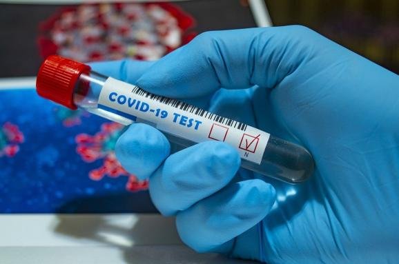 COVID-19 на Донеччині: 548 нових випадків коронавірусної хвороби