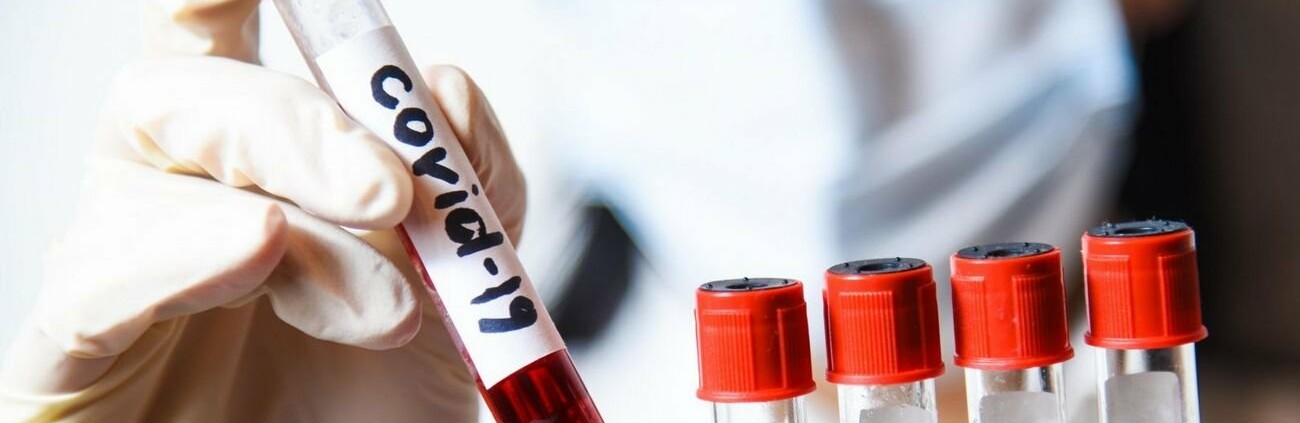 Оперативна інформація по Краматорську відносно захворюваності на COVID-19: + 97 випадків