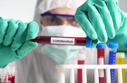 Оперативна інформація по Краматорську відносно захворюваності на COVID-19: + 63 випадки
