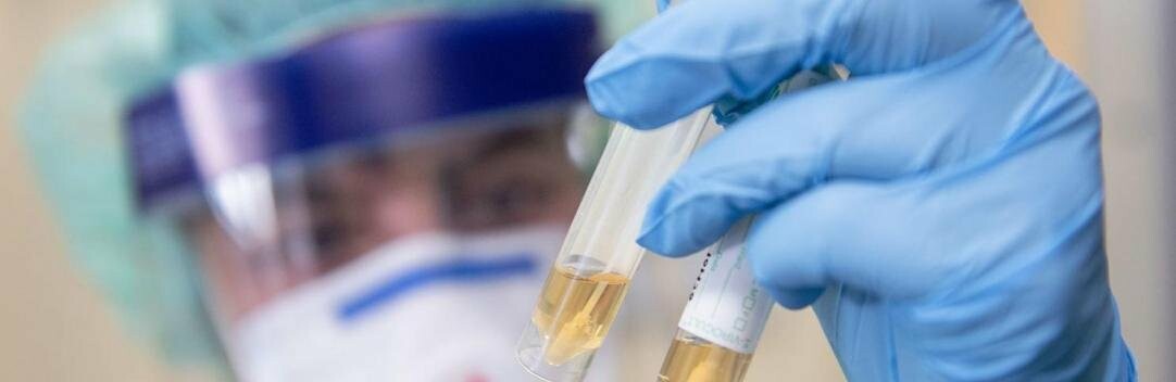 В Украине 2608 новых случаев коронавируса