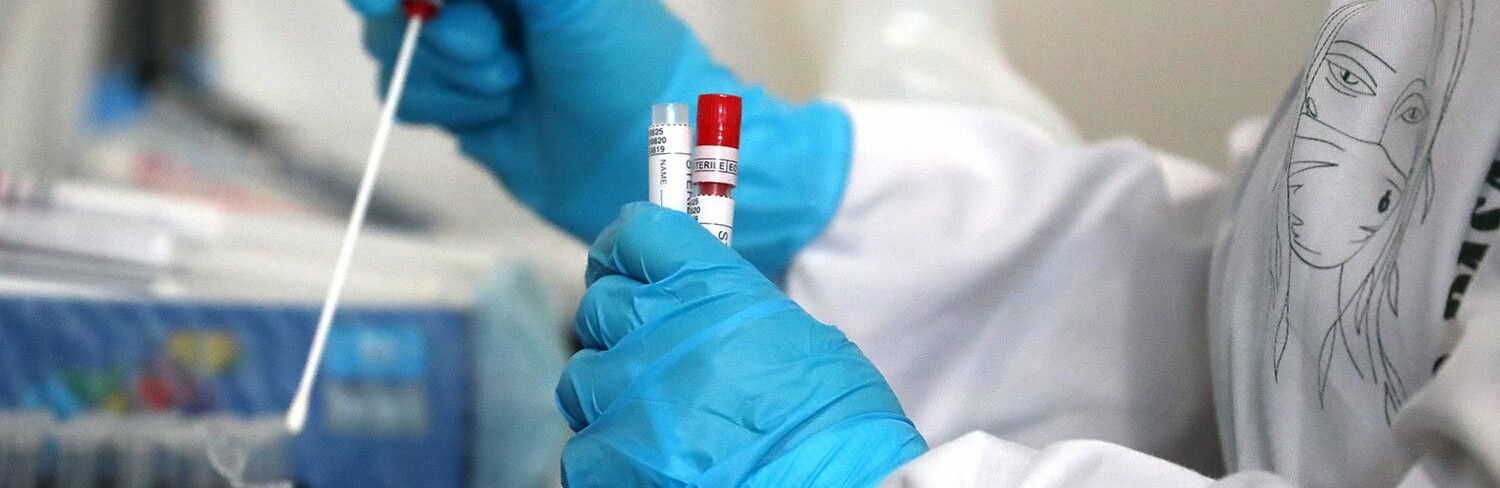 На Донетчине скончался еще 21 больной коронавирусной инфекцией