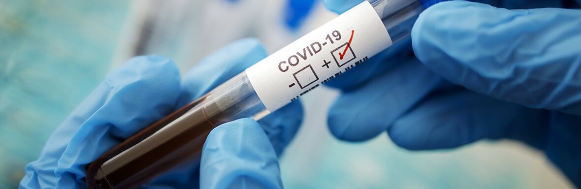В Донецкой области скончались еще шесть больных COVID-19 В Донецкой области скончались еще шесть больных COVID-19